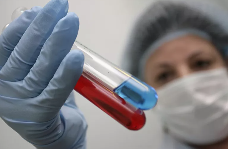 Controladores de elite’ podem curar-se do HIV sem qualquer tratamento médico, revelam pesquisas