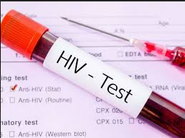 Vacina contra HIV será testada no Brasil
